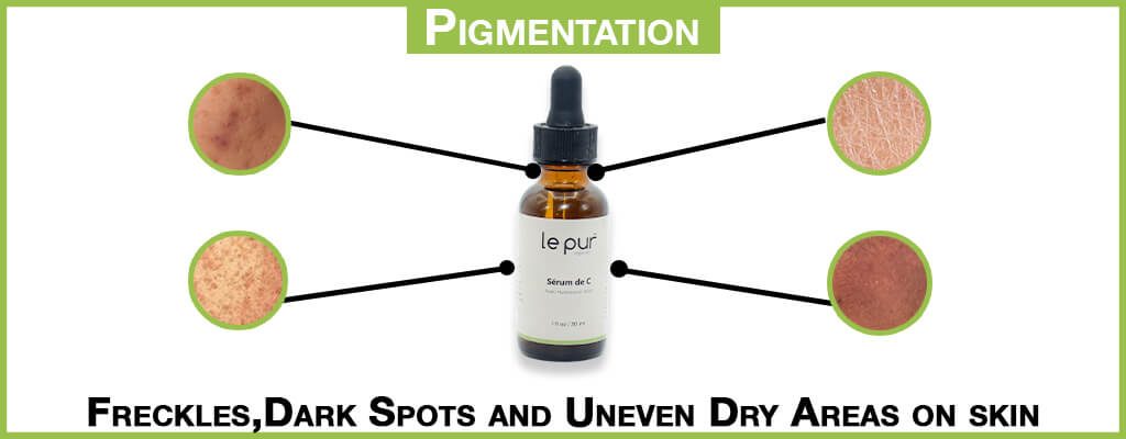 Pigmentation Pigmentation