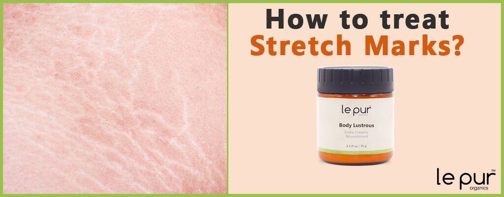 Treat your stretch marks of your belly & legs with Organic Body Butter