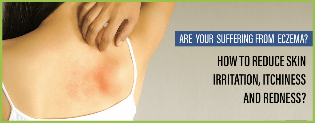 Here’s The Best Creams in Pakistan for Treatment of Eczema