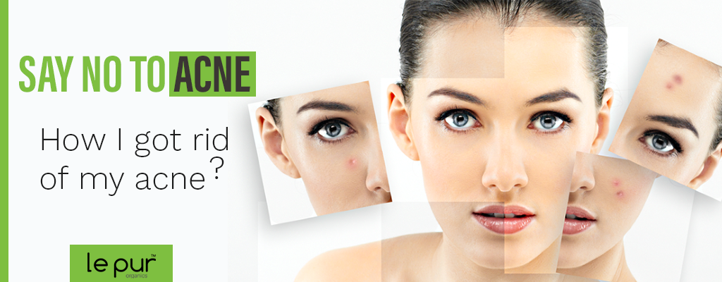 acne-scars-cream-in-pakistan