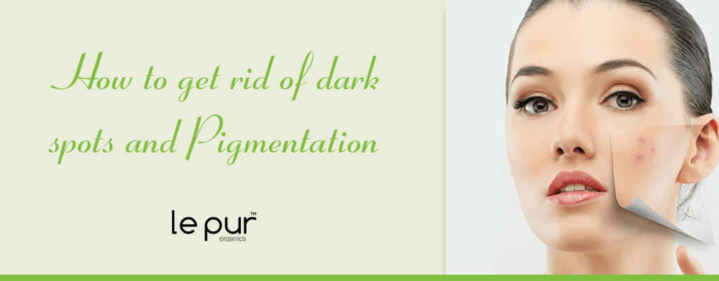pigmentation Cream in pakistan
