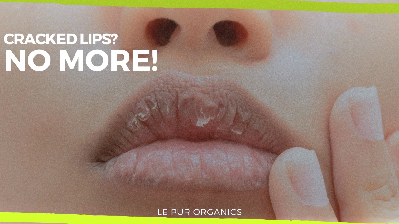 Cracked Lips