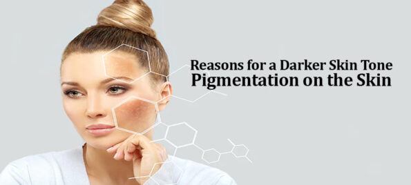 Pigmentation on the Skin