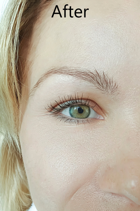 after Benefits of Retinol after