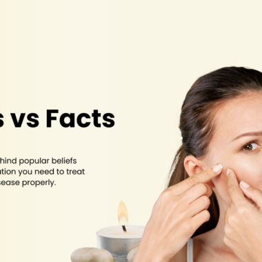 Uncovering the Truth about Acne: Myths vs Facts