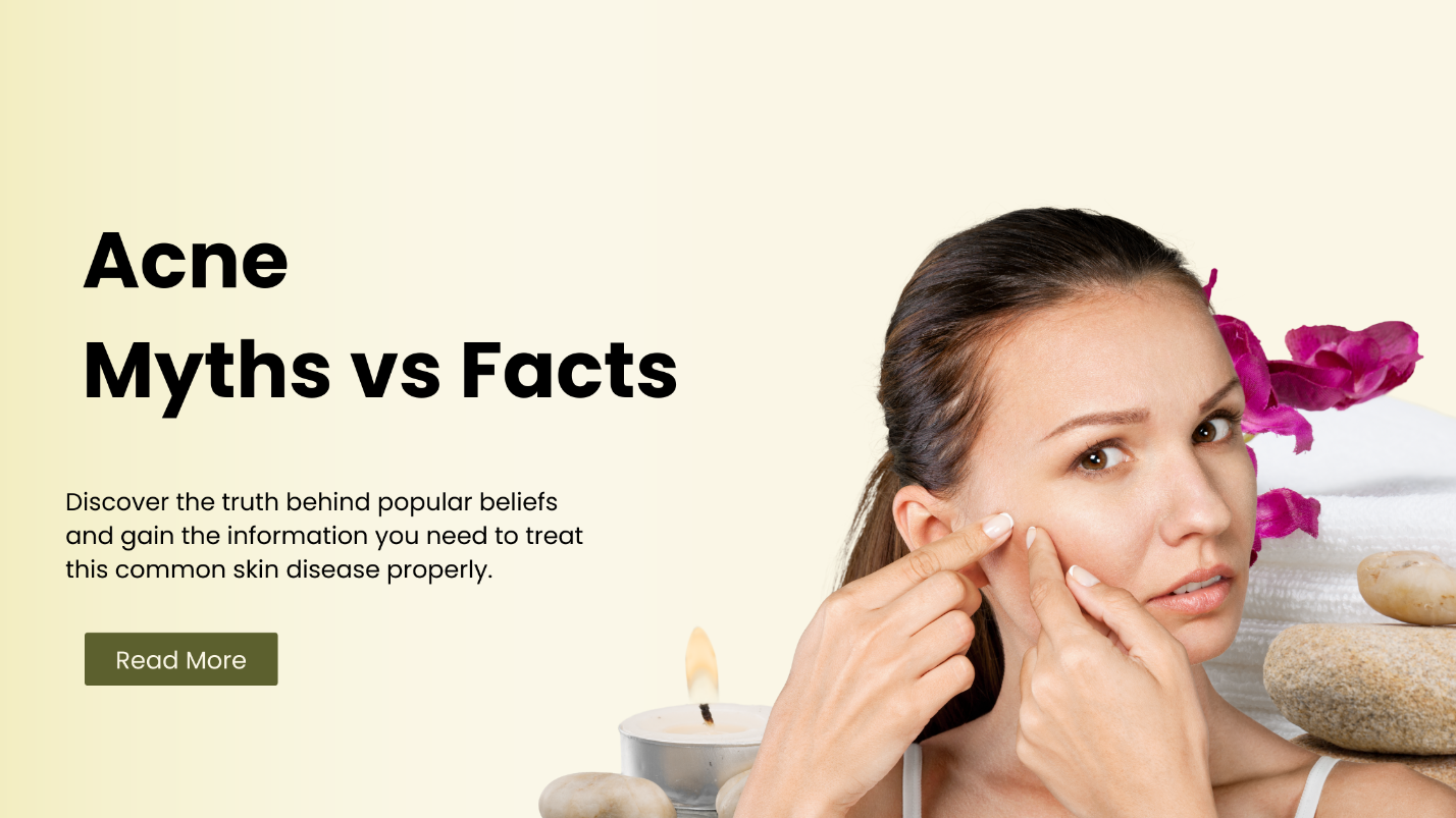 Acne Myths vs Facts