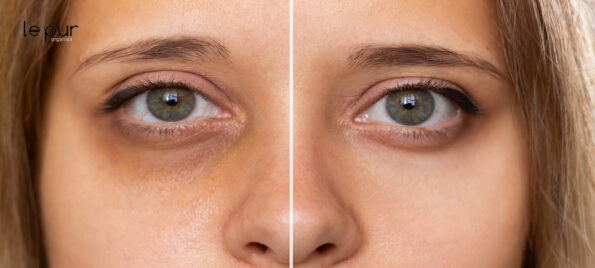 le pur Organic Dark Circle Creams