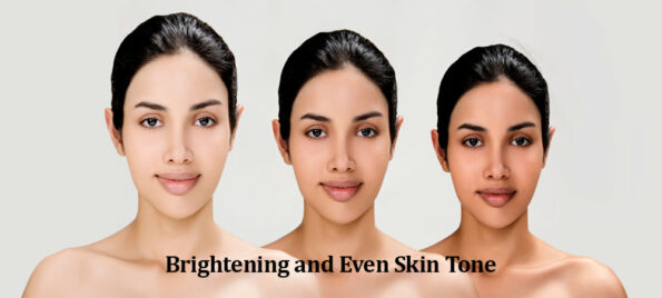 Brightening and Even Skin Tone